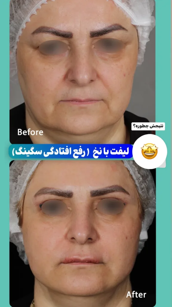 کلینیک زیبایی دکتر شادی مظلومی کرج