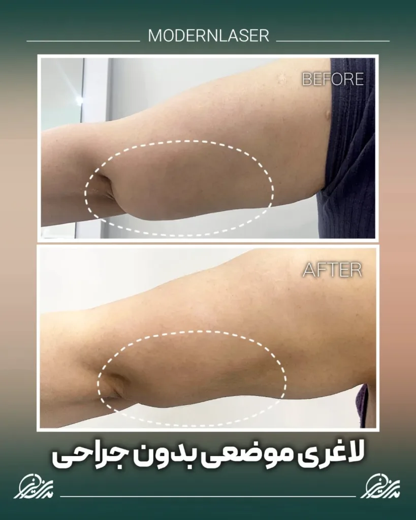 نمونه کار کلینیک مدرن لیزر اصفهان