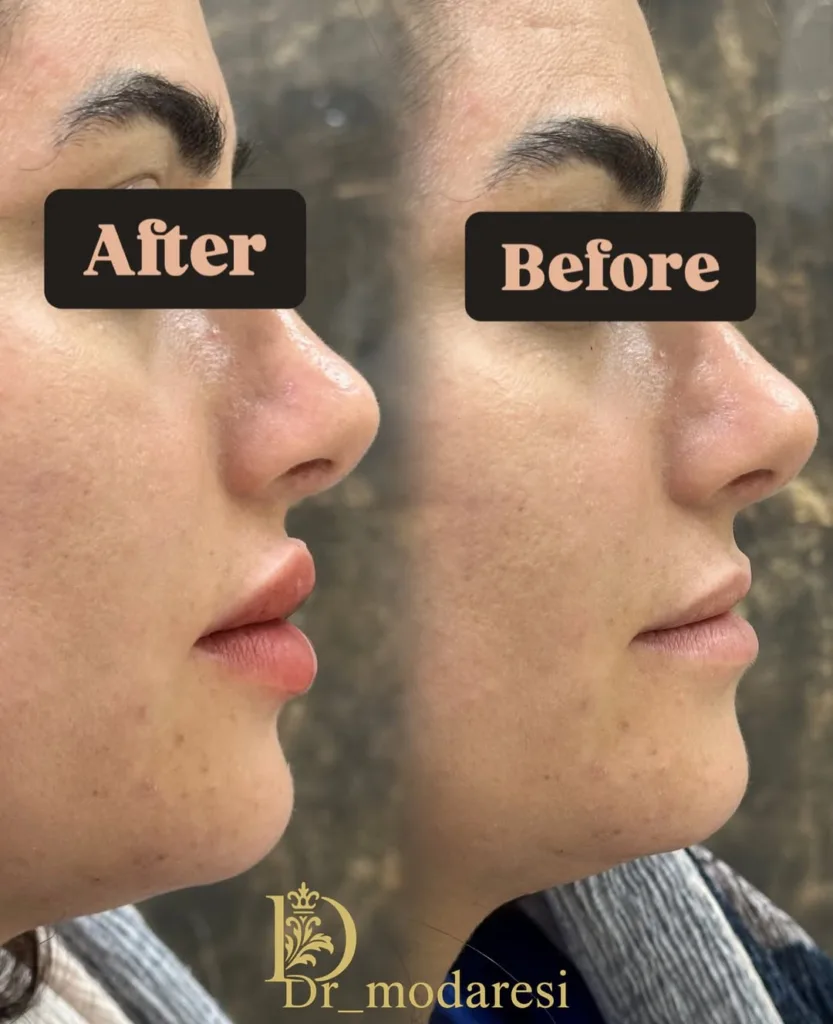 نمونه کار کلینیک زیبایی دکتر مدرسی اصفهان