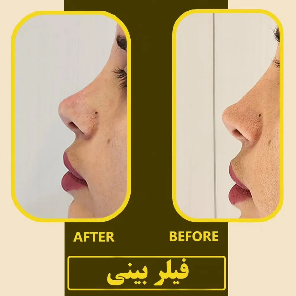 نمونه کار کلینیک زیبایی ژالان اصفهان
