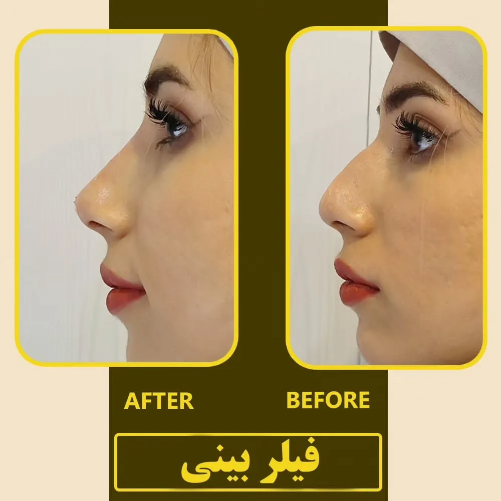 نمونه کار کلینیک زیبایی ژالان اصفهان