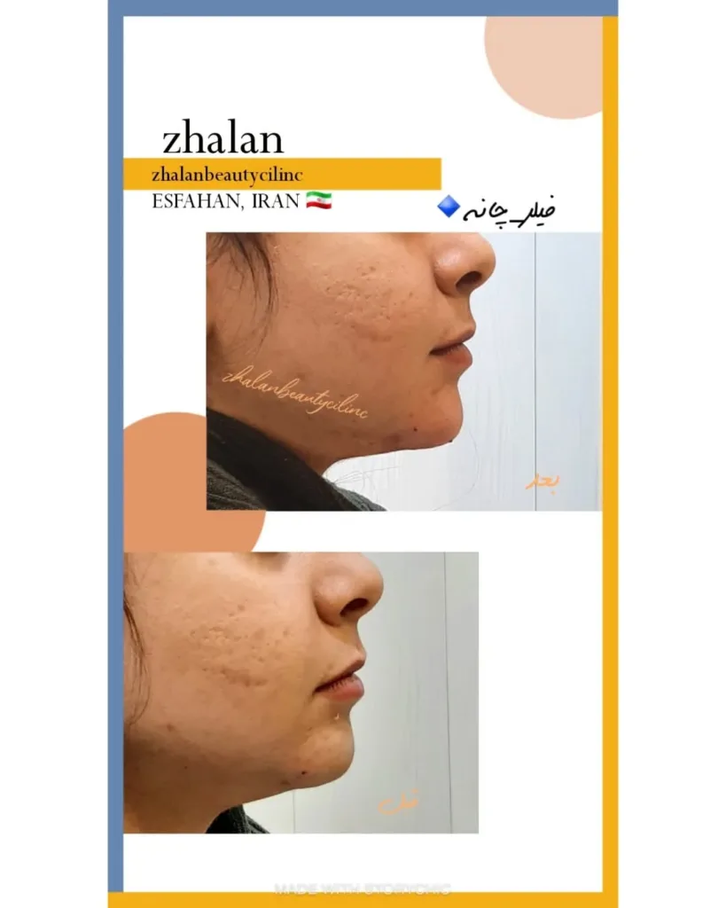 نمونه کار کلینیک زیبایی ژالان اصفهان