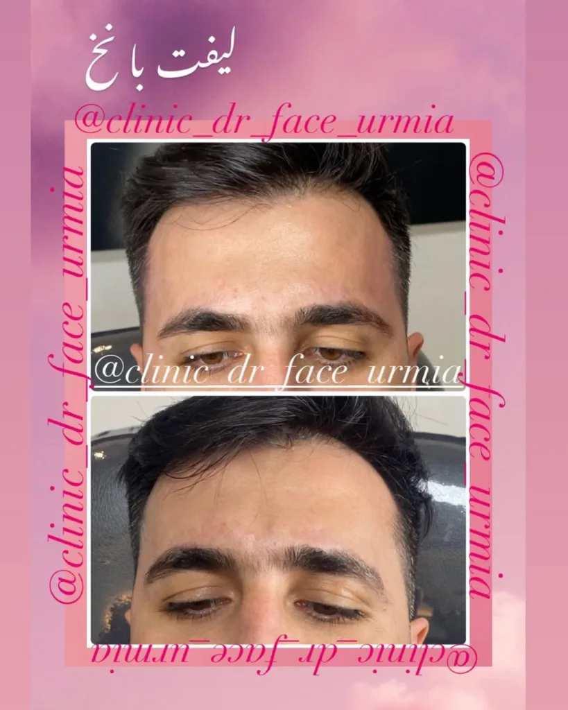 نمونه کار کلینیک زیبایی دکتر فرزانه پاکزاد ارومیه