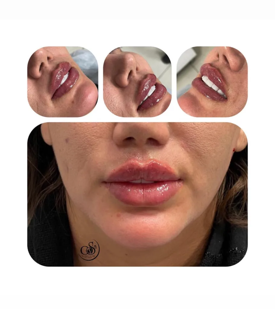 نمونه کار کلینیک زیبایی دکتر امید صفری ارومیه