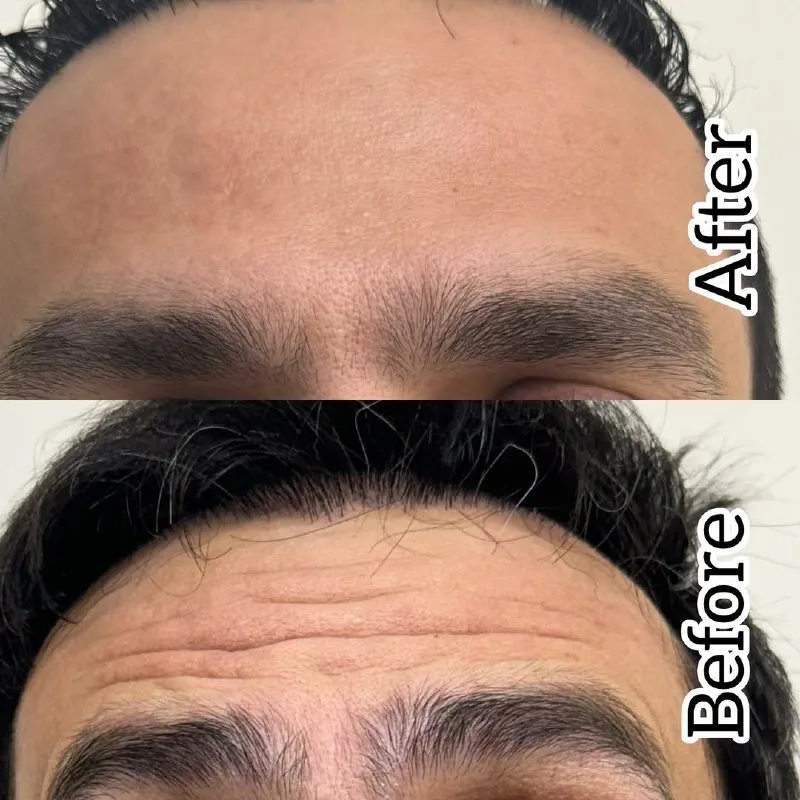 نمونه کار کلینیک زیبایی دکتر سحر پارسایی ارومیه
