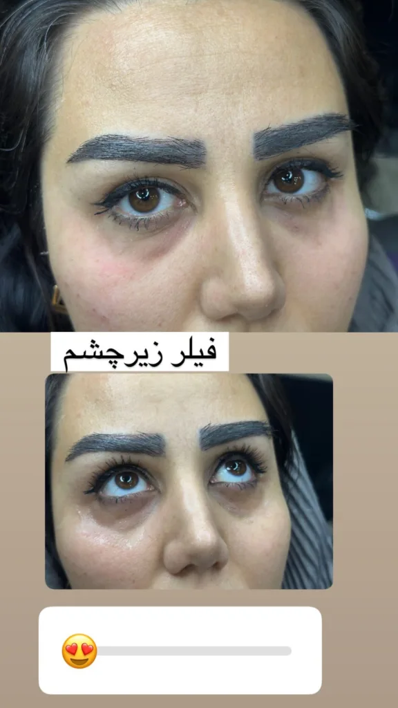 نمونه کار کلینیک زیبایی کلینیک لیزر مونالیزا ارومیه