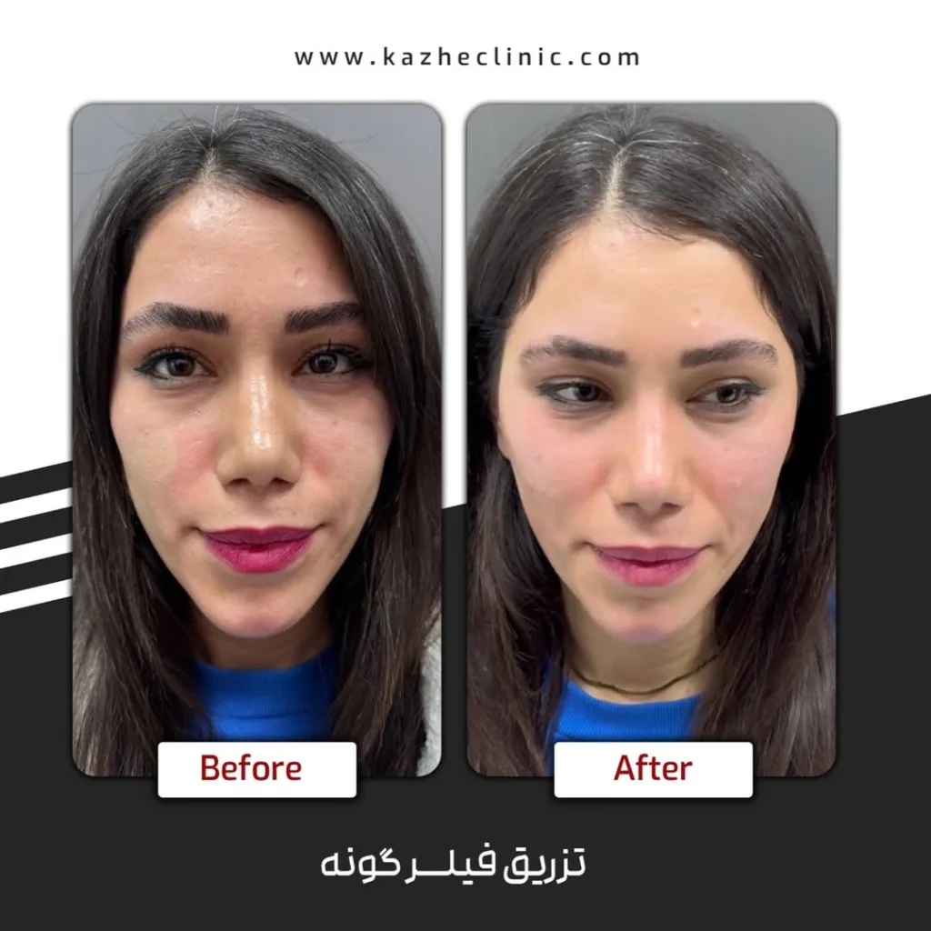 نمونه کار کلینیک زیبایی دکتر کاژه دادگری ساری