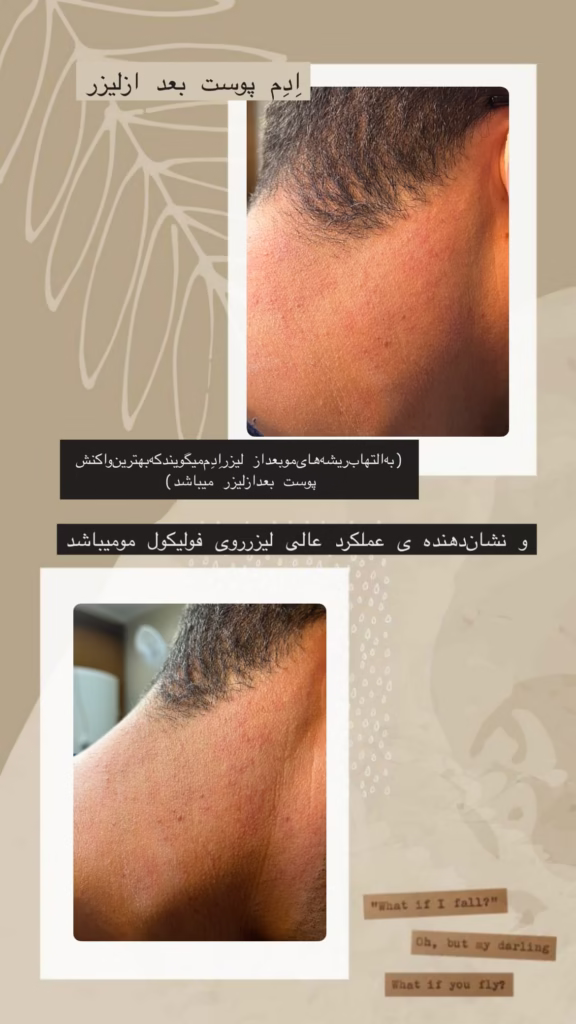 نمونه کار کلینیک دکتر ایمان مومنی اصفهان