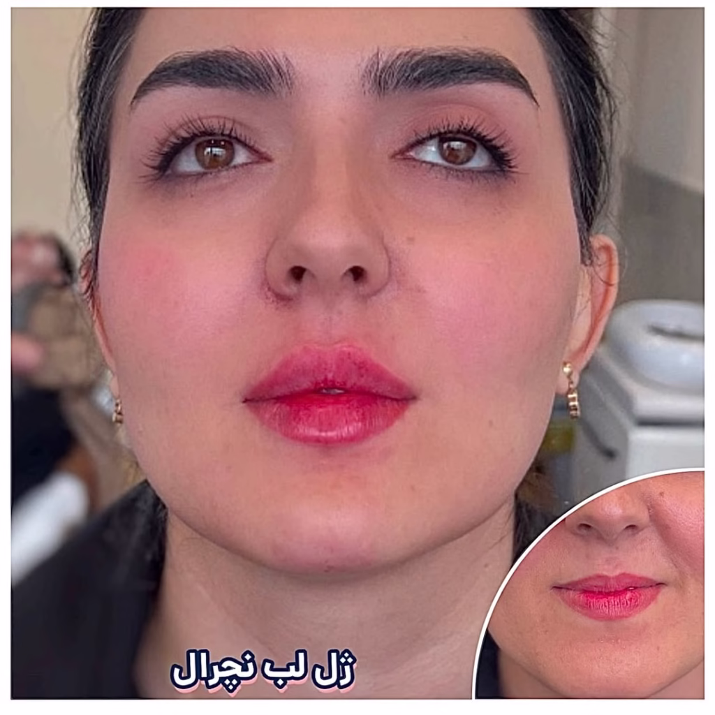 نمونه کار کلینیک زیبایی دکتر شهبازی و طلوعی اردبیل