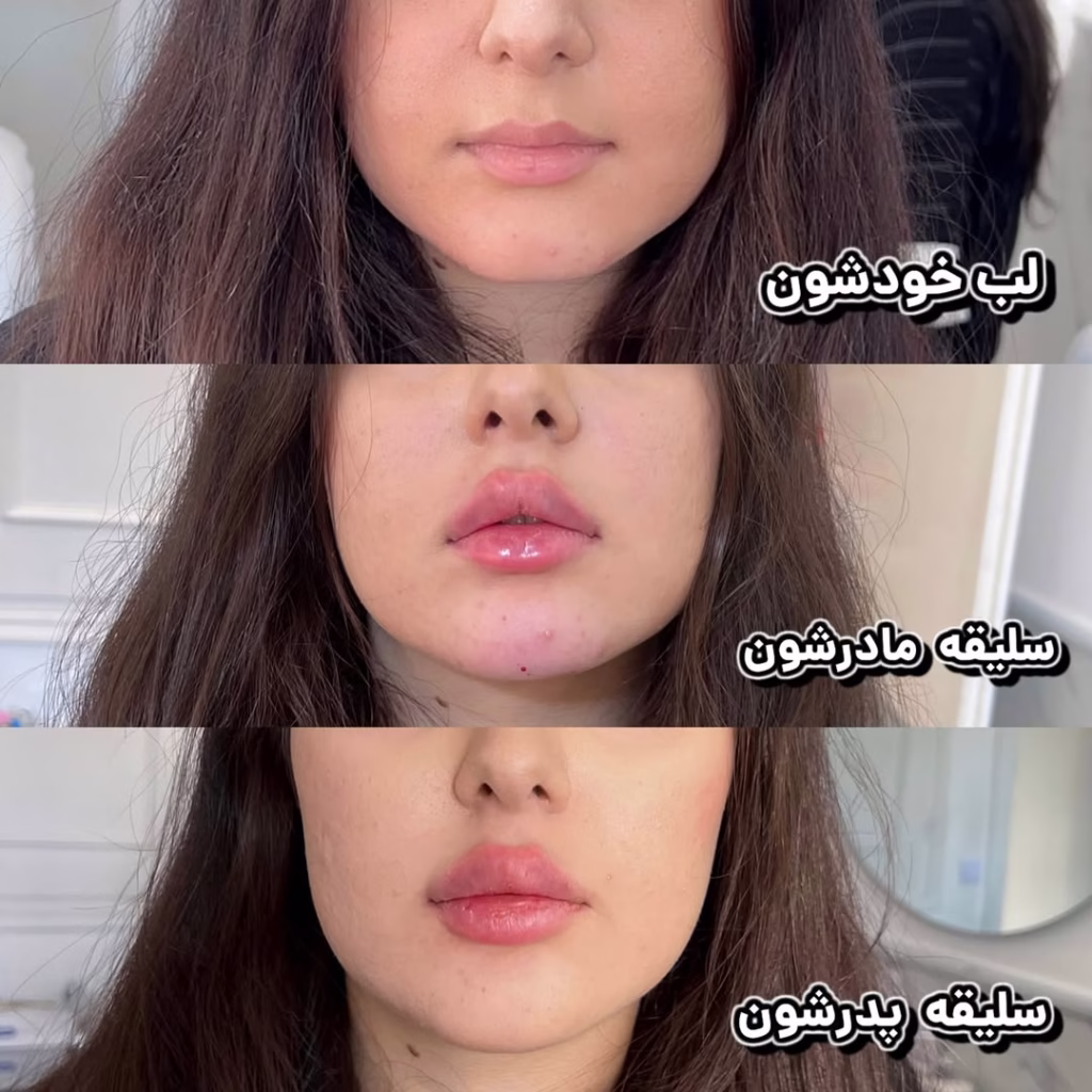 نمونه کار کلینیک زیبایی دکتر شهبازی و طلوعی اردبیل