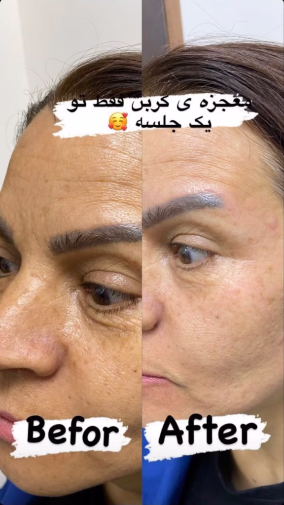 نمونه کار کلینیک کلینیک زیبایی پوست مو لیزر آینا اراک