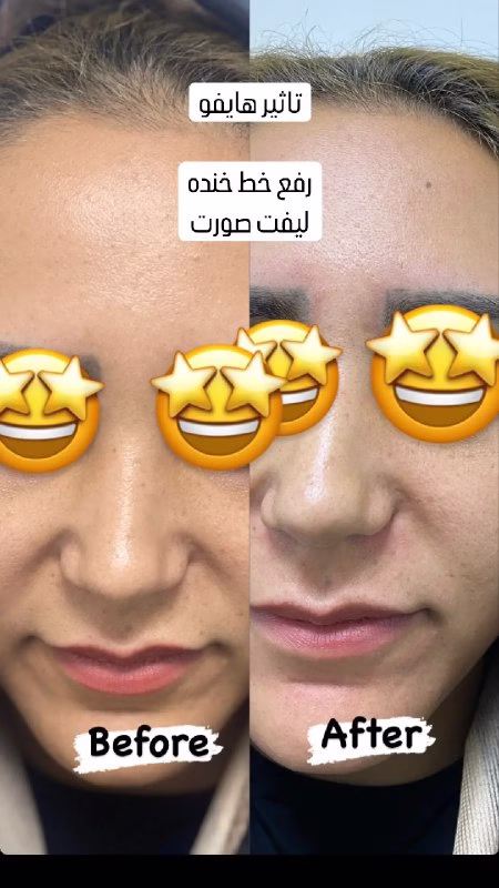 نمونه کار کلینیک کلینیک زیبایی پوست مو لیزر آینا اراک
