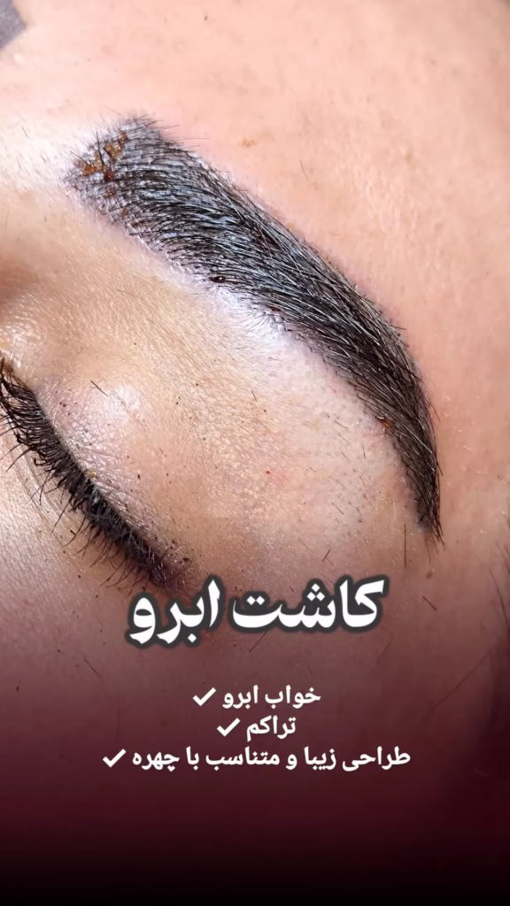نمونه کار کلینیک زیبایی دکتر ریما سرحدیان ارومیه