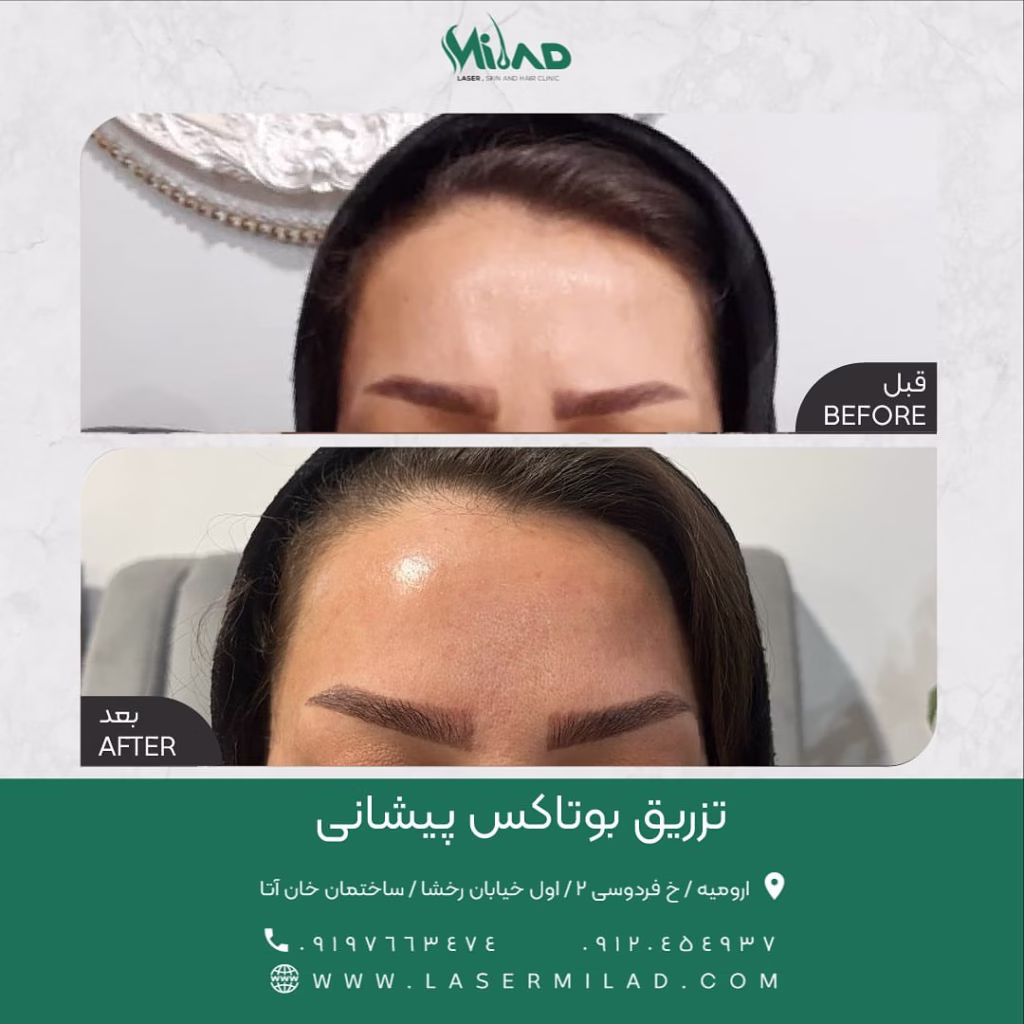 نمونه کار کلینیک خدمات لیزر پوست و مو و زیبایی میلاد ارومیه